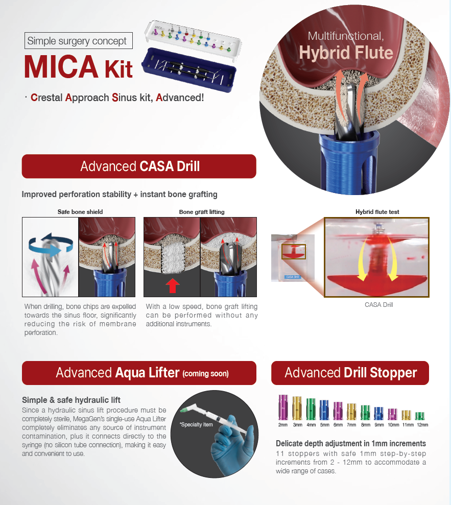 MICA kit (MKCA3000S)