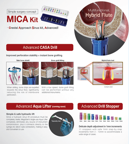 MICA kit (MKCA3000S)