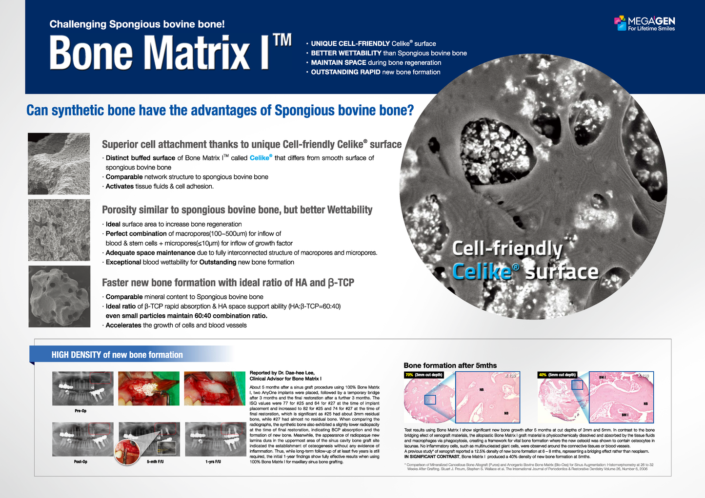 Bone Matrix I